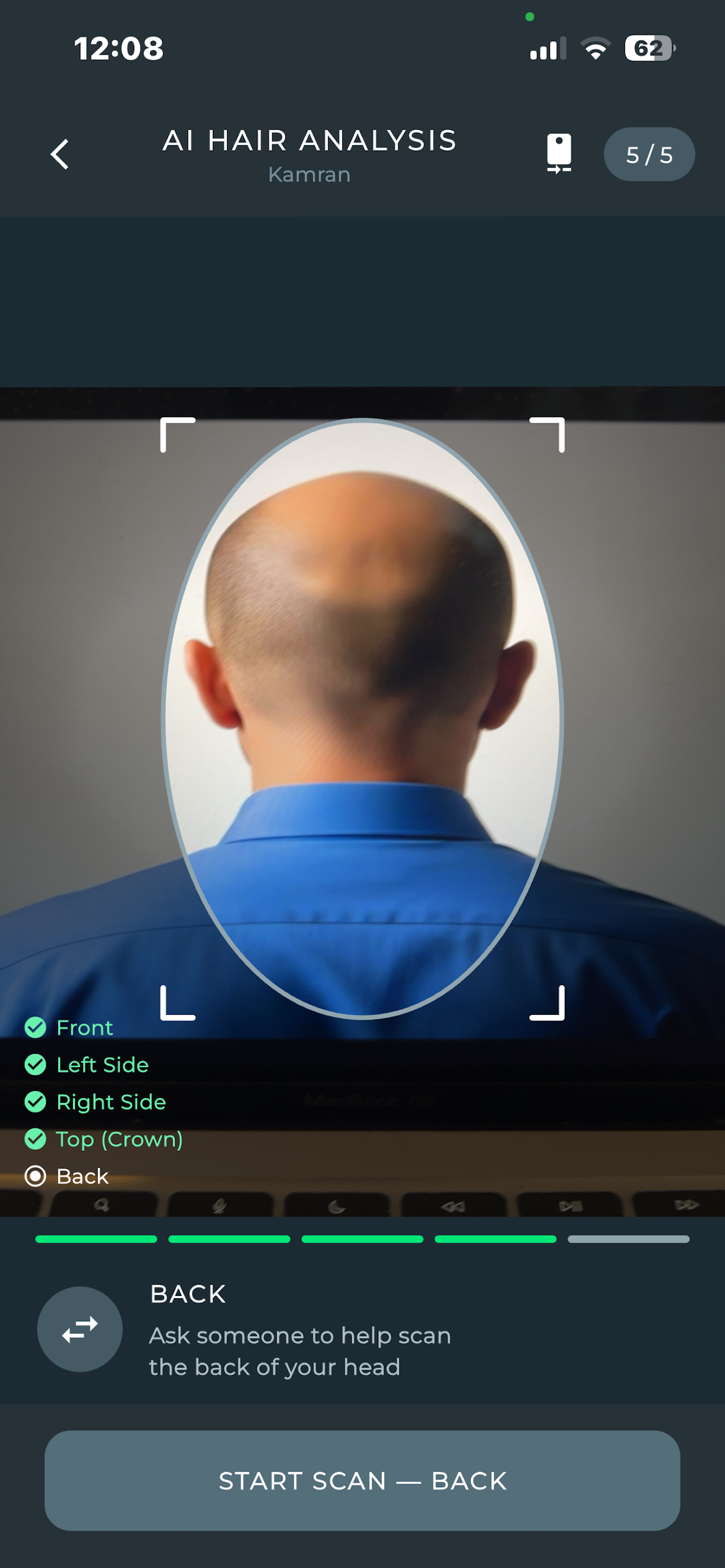 SurgiTracker – Hair & Scalp AI screenshot 3