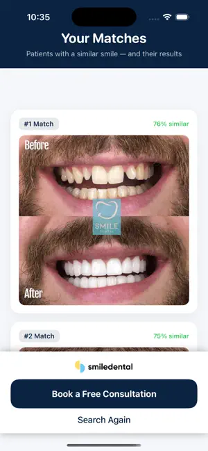 Smile Makeover screenshot 1