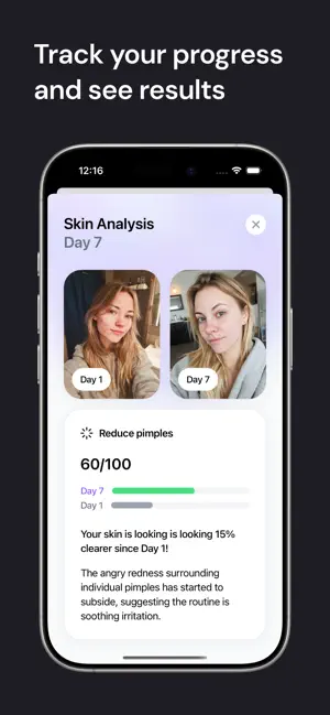 Halo: Clear Skin in 55 Days screenshot 4