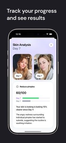 Halo: Clear Skin in 55 Days iPhone screenshot