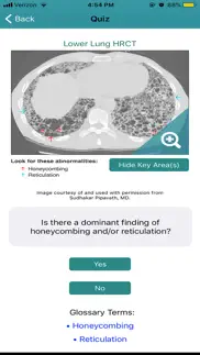 rad rounds uip to ipf problems & solutions and troubleshooting guide - 2