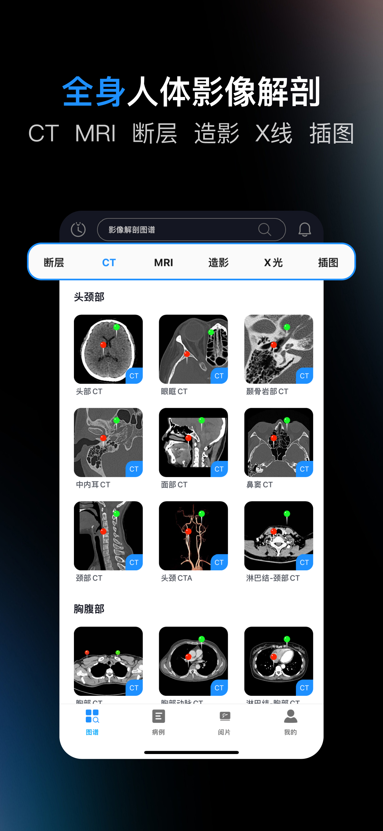 影像解剖图谱-人体断层影像图集和病例大全