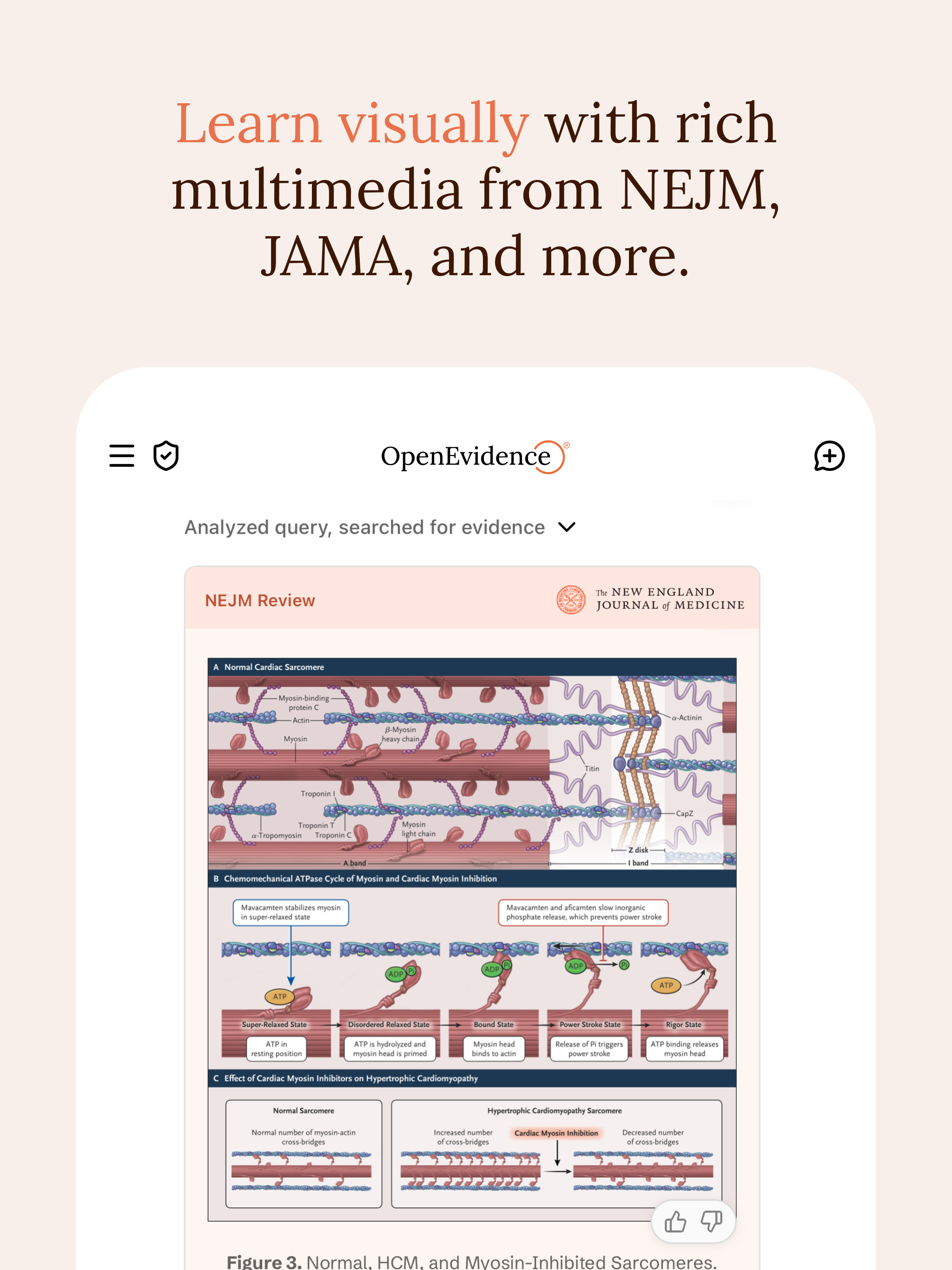 OpenEvidence screenshot 11