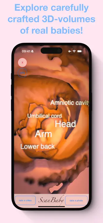 ScanBaby learn baby ultrasoundのスクリーンショット（5/8）