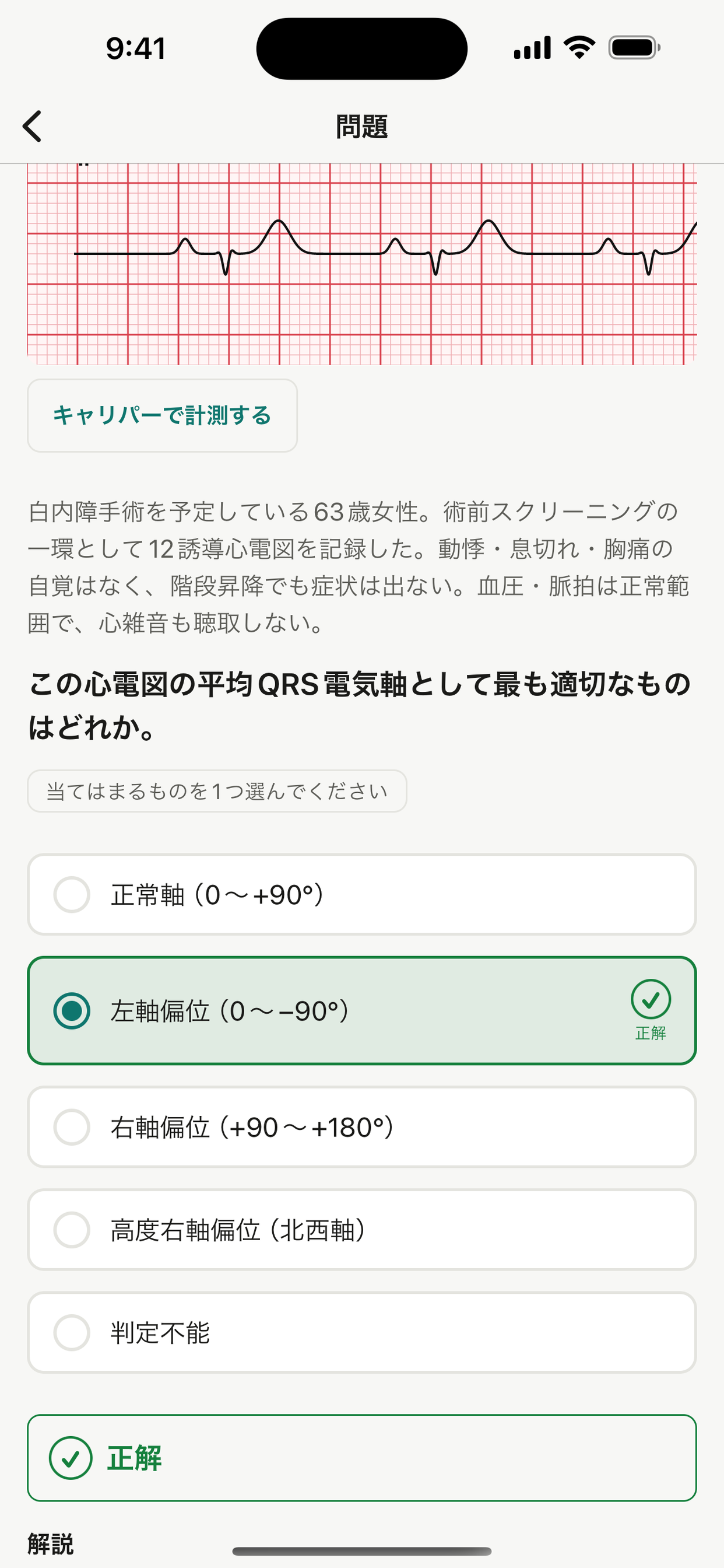 心電図トレーニング screenshot 2