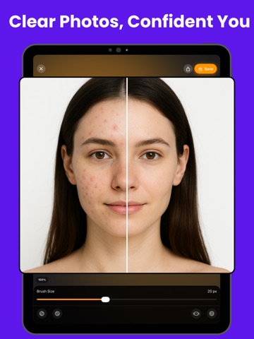 Acne Remover - Face Retouch iPad screenshot