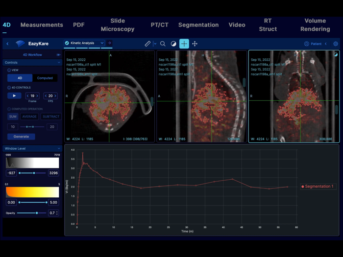 EazyGo  Easy PACS  DICOM