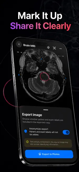 DICOM Viewer: MRI CT Studio screenshot 3