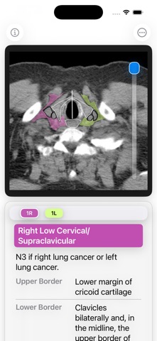 Thoracic Lymph Node Map screenshot