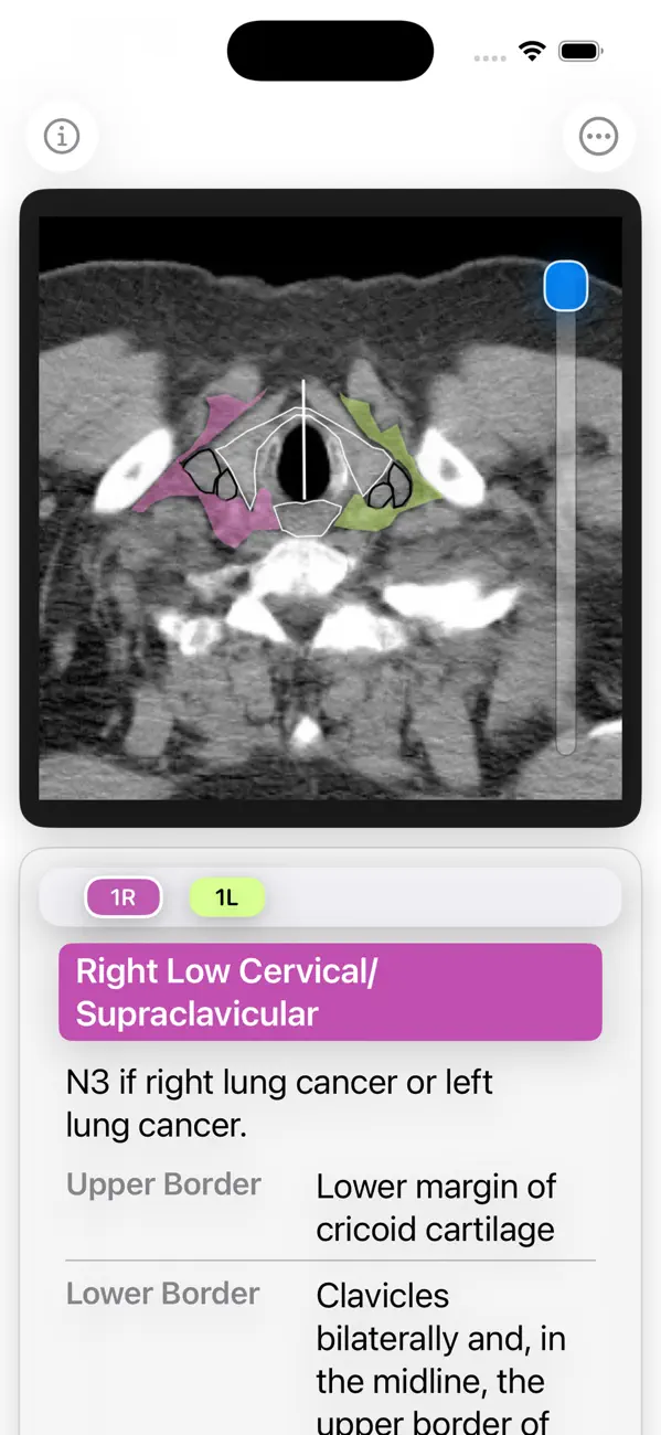 Screenshot #3 pour Thoracic Lymph Node Map
