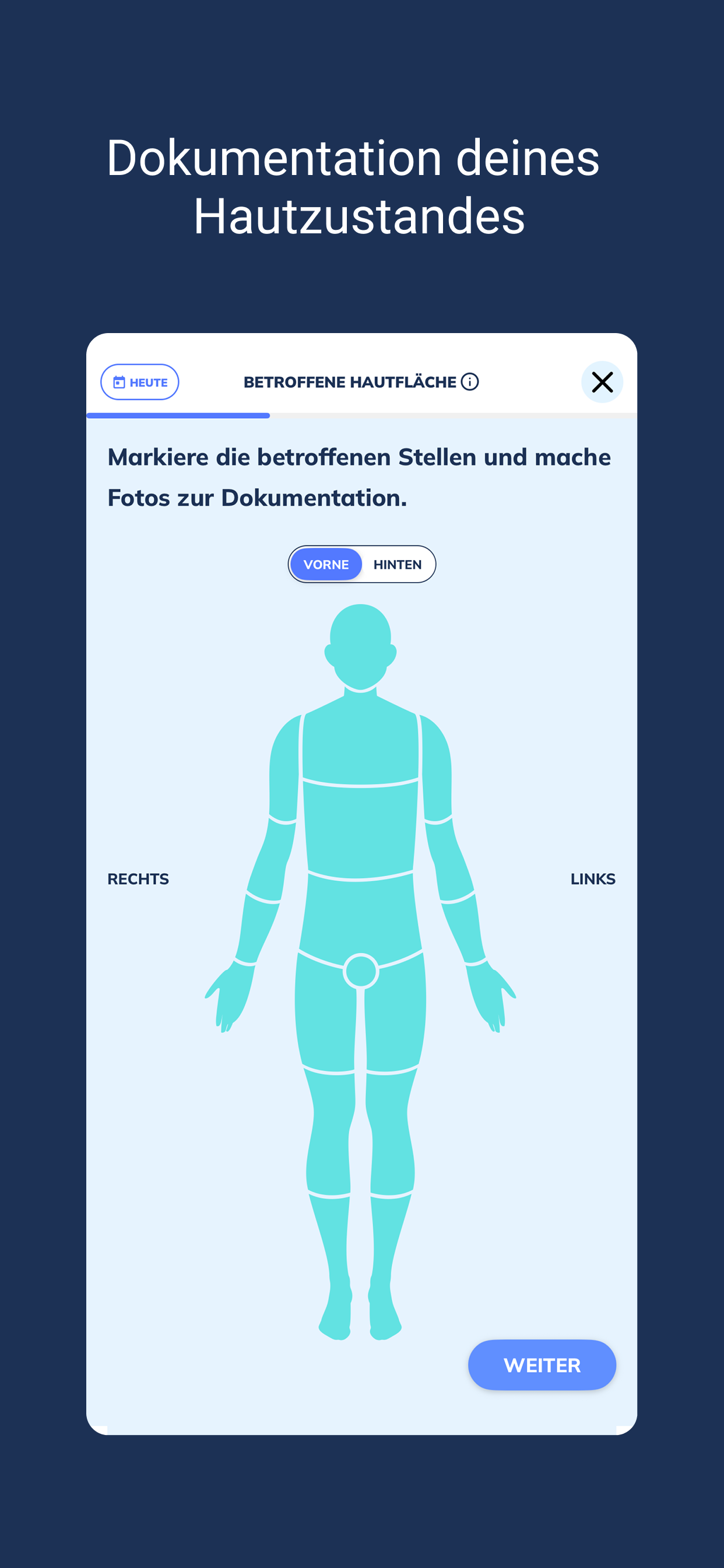 Psoriasis App | Sorea