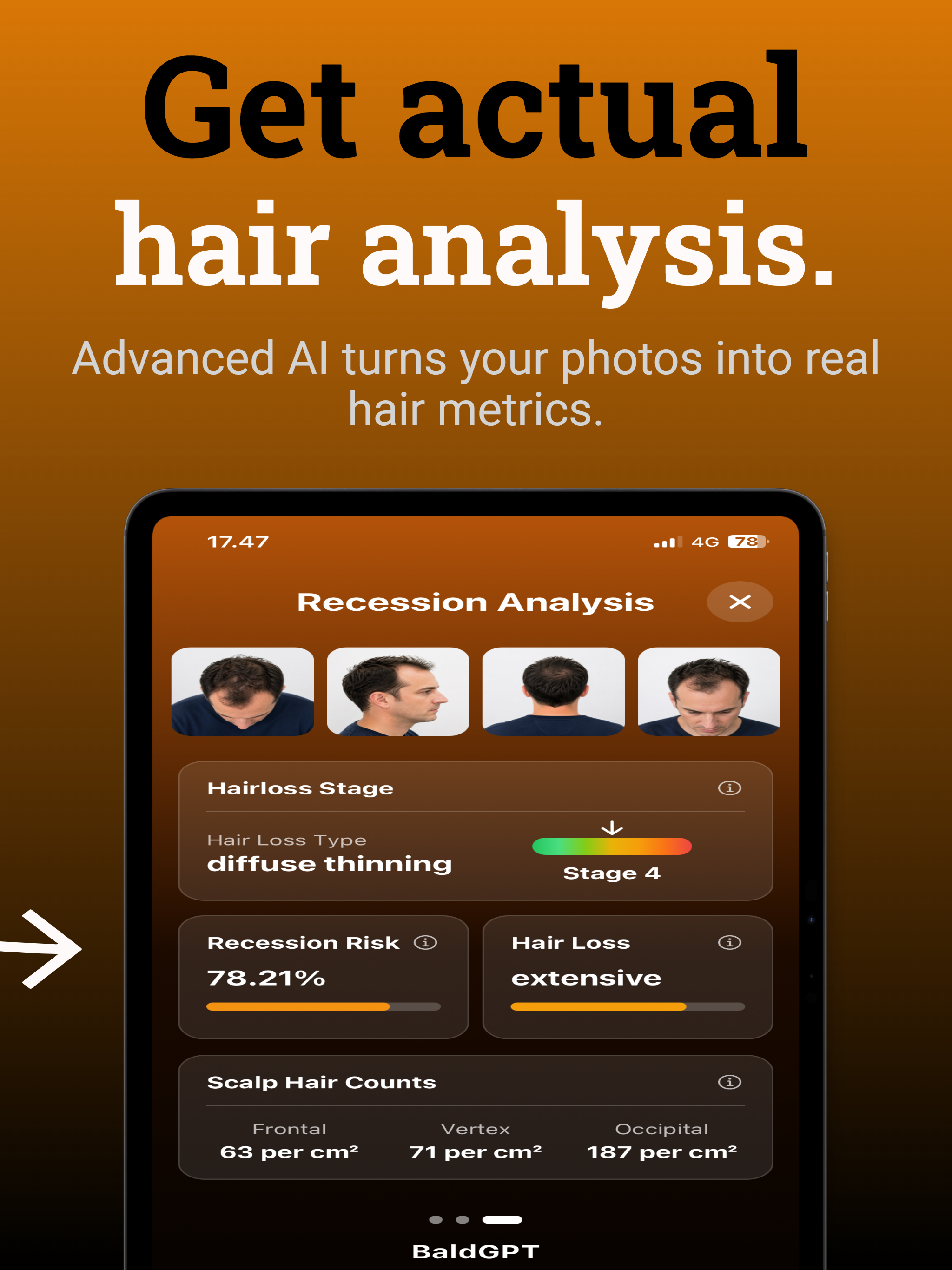 BaldGPT screenshot 8
