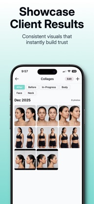 GlowPro MD: Before & After screenshot 3