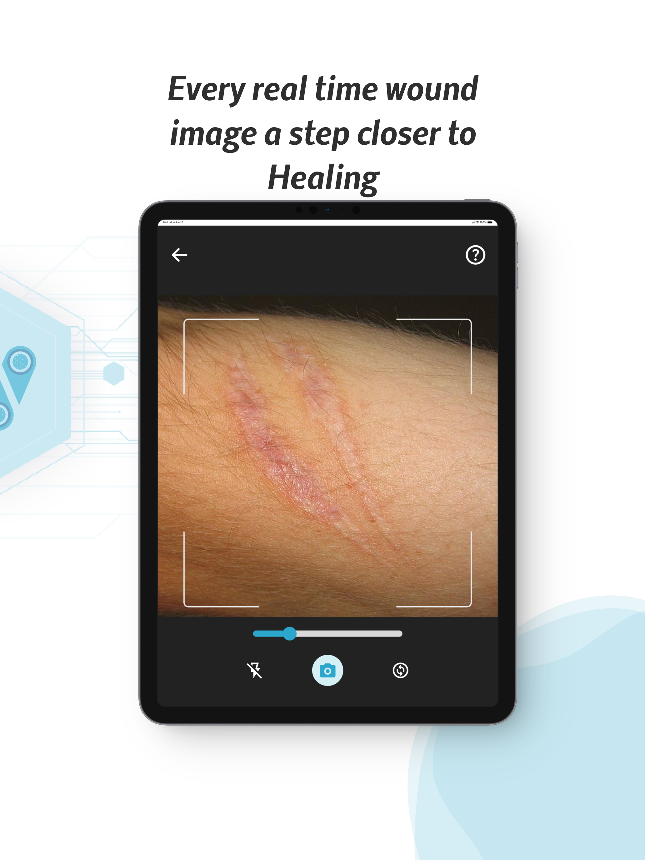 WoundTele: AI Wound Care