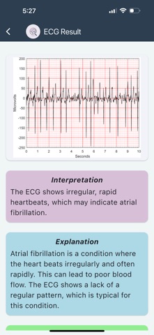 ECG - Smart Screenshot 6 of 6