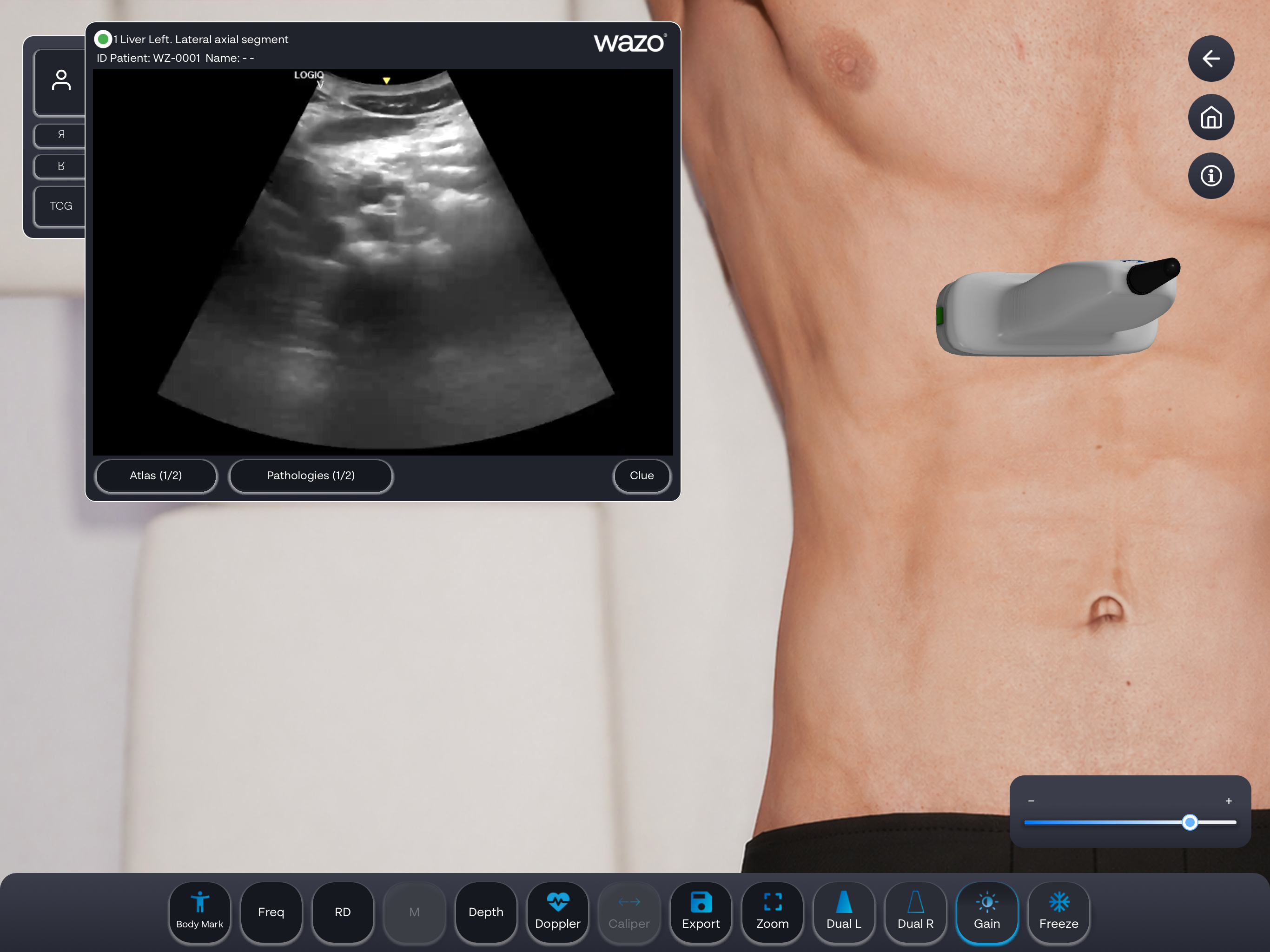 Wazo Ultrasound Simulator screenshot 16