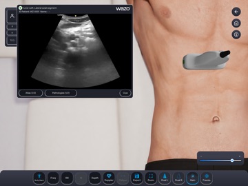 Wazo Ultrasound Simulator iPad screenshot 9