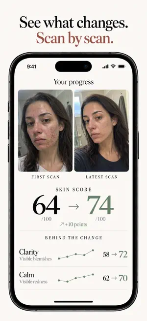 Lerin - AI Skin Scanner screenshot 2