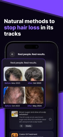 Hair Snap Health & Style Scan screenshot