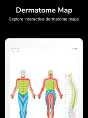 dermatome map and tuning fork ipad resimleri 1