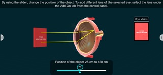 Vision Defects – EduTech Era iPhone screenshot