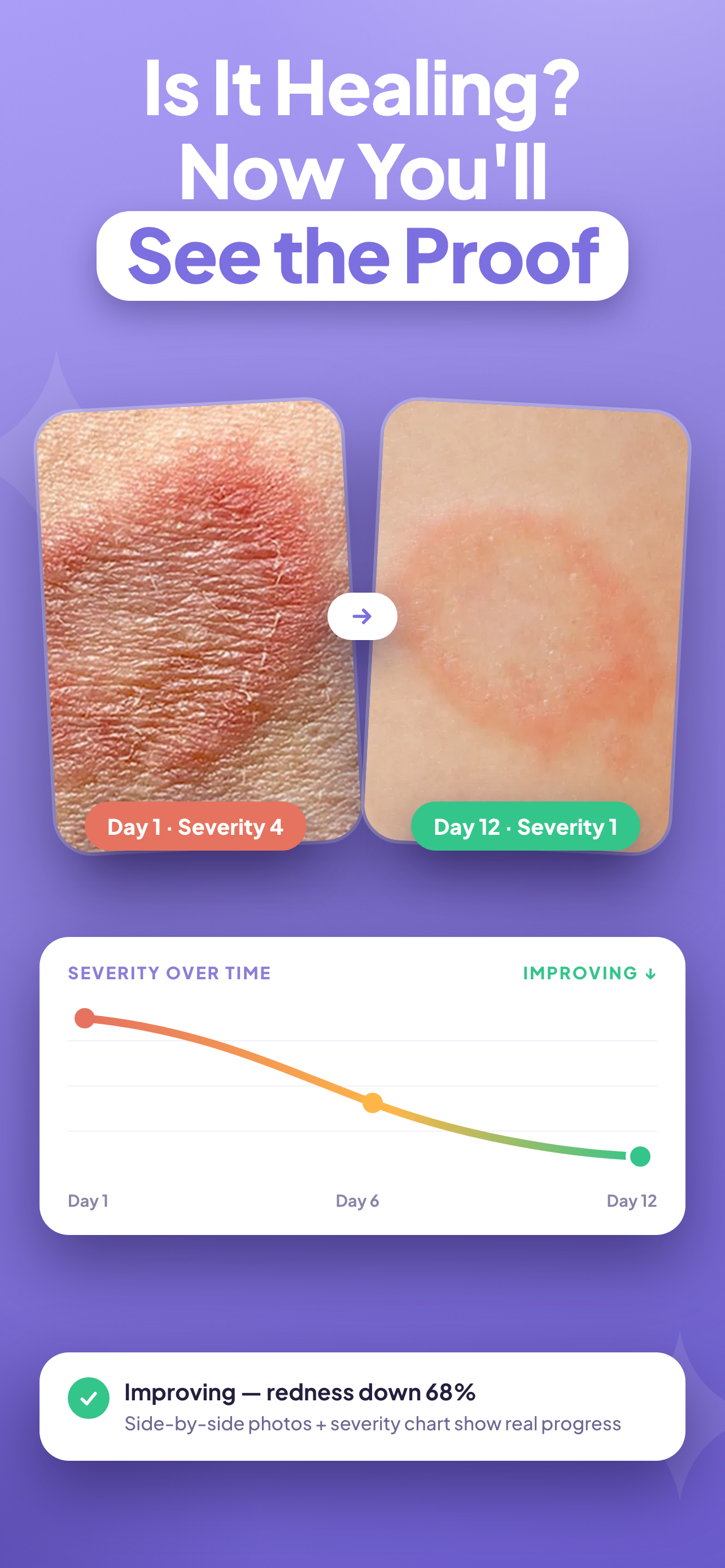 Rash Scan: AI Dermatologist screenshot 3