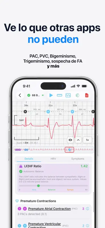 HeartLab: 心電図プロ分析 screenshot 2 of 8
