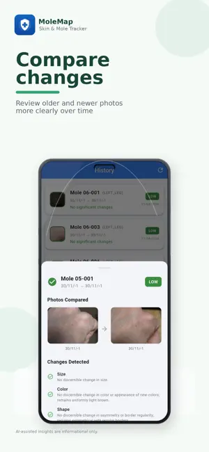 MoleMap: Skin & Mole Tracker screenshot 2