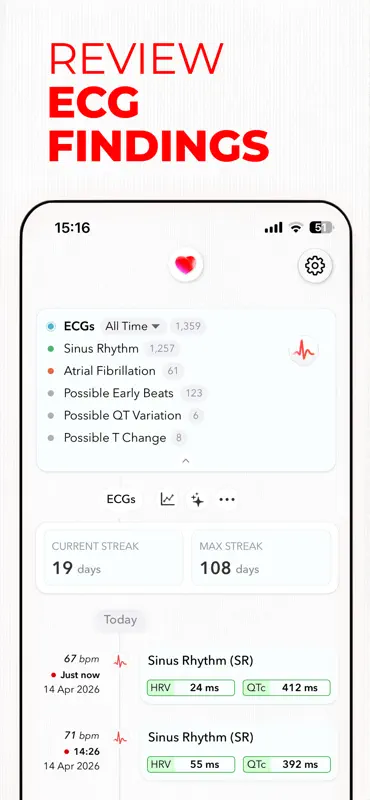ECG+ | Your Watch ECG Reader screenshot 5 of 9