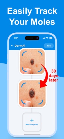 Mole Checker & Scanner: DermAi Screenshot 2 of 4