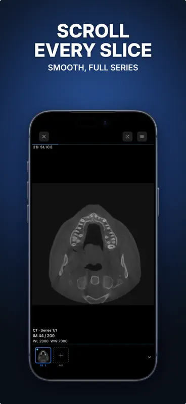 Ossidex: DICOM Viewer CT & MRI screenshot 6 of 6