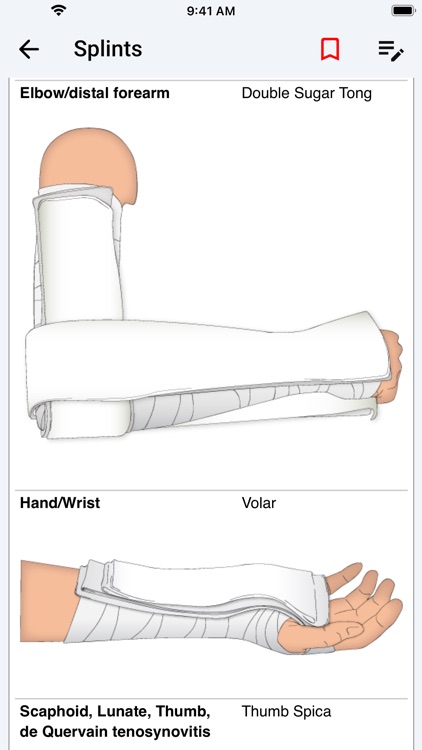 palmEM AI: EM Quick Reference