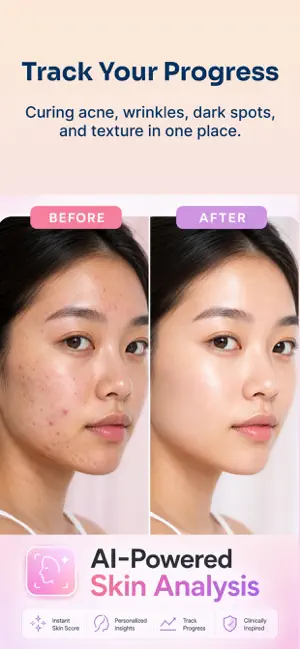 GlowScan AI Skin Acne Scanner screenshot 4