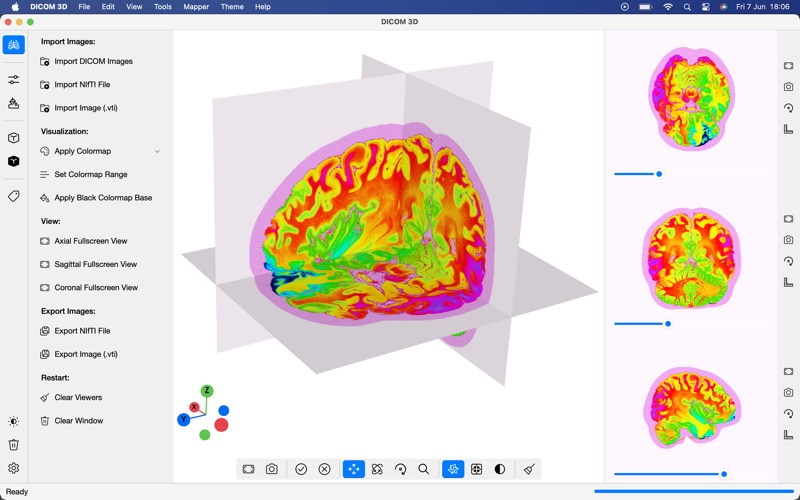 DICOM 3D Screenshot