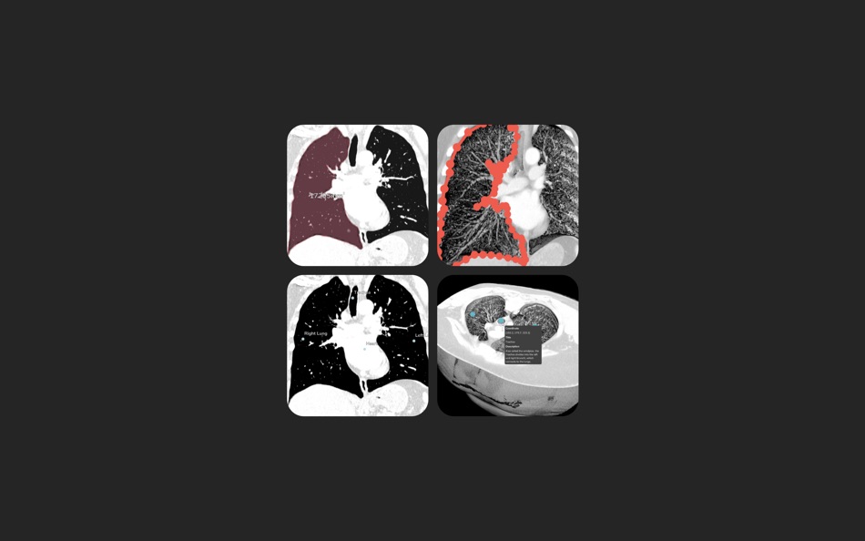 #1. DICOM Viewer+ (macOS) Podle: 远腾 李