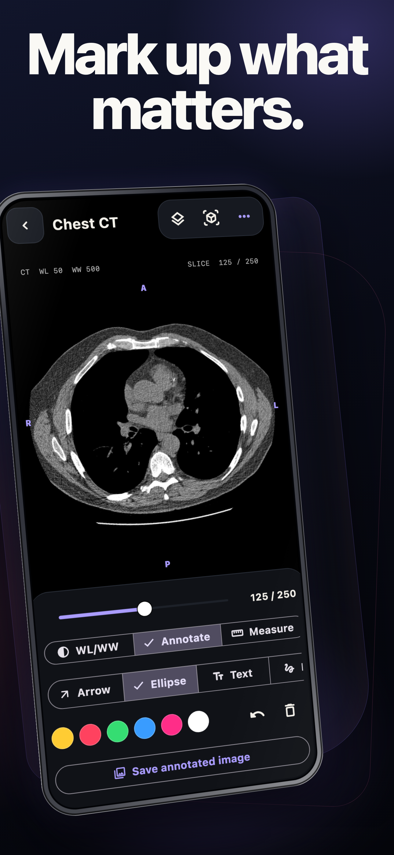 DICOM Studio: MRI CT Viewer screenshot 4