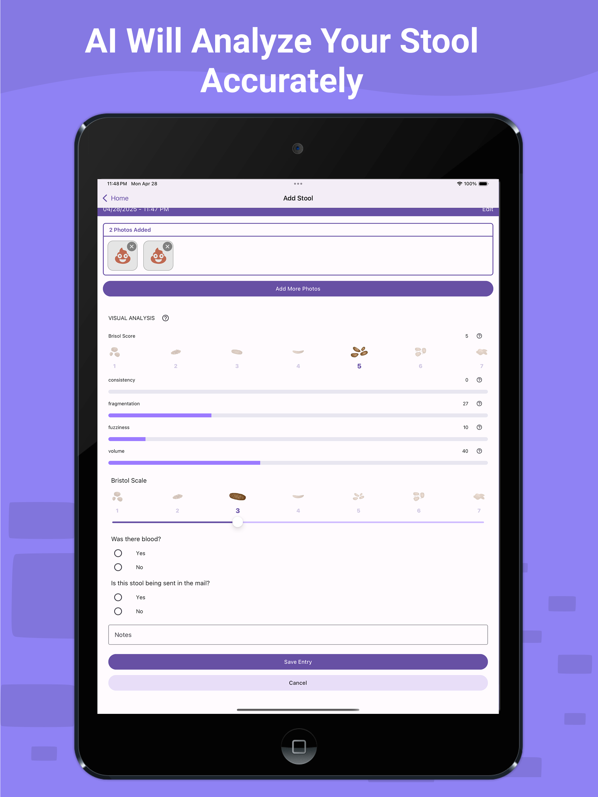 Dieta Stool AI Tracker
