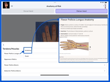 Anatomy at Risk iPad screenshot