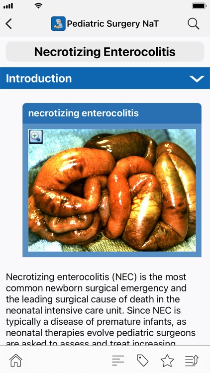 APSA Pediatric Surgery Library