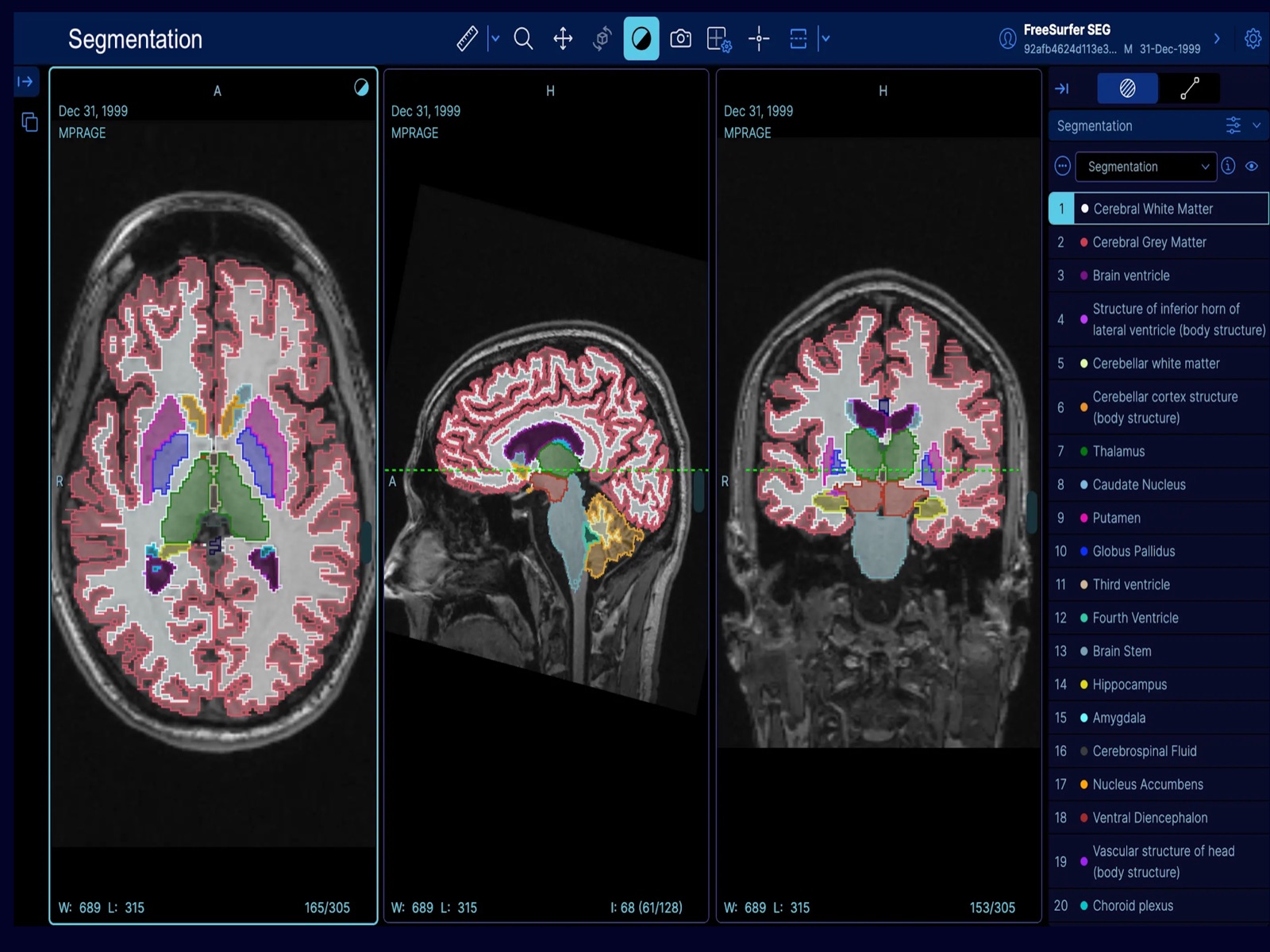 EazyGo | Easy PACS & DICOM ipad screenshot 3