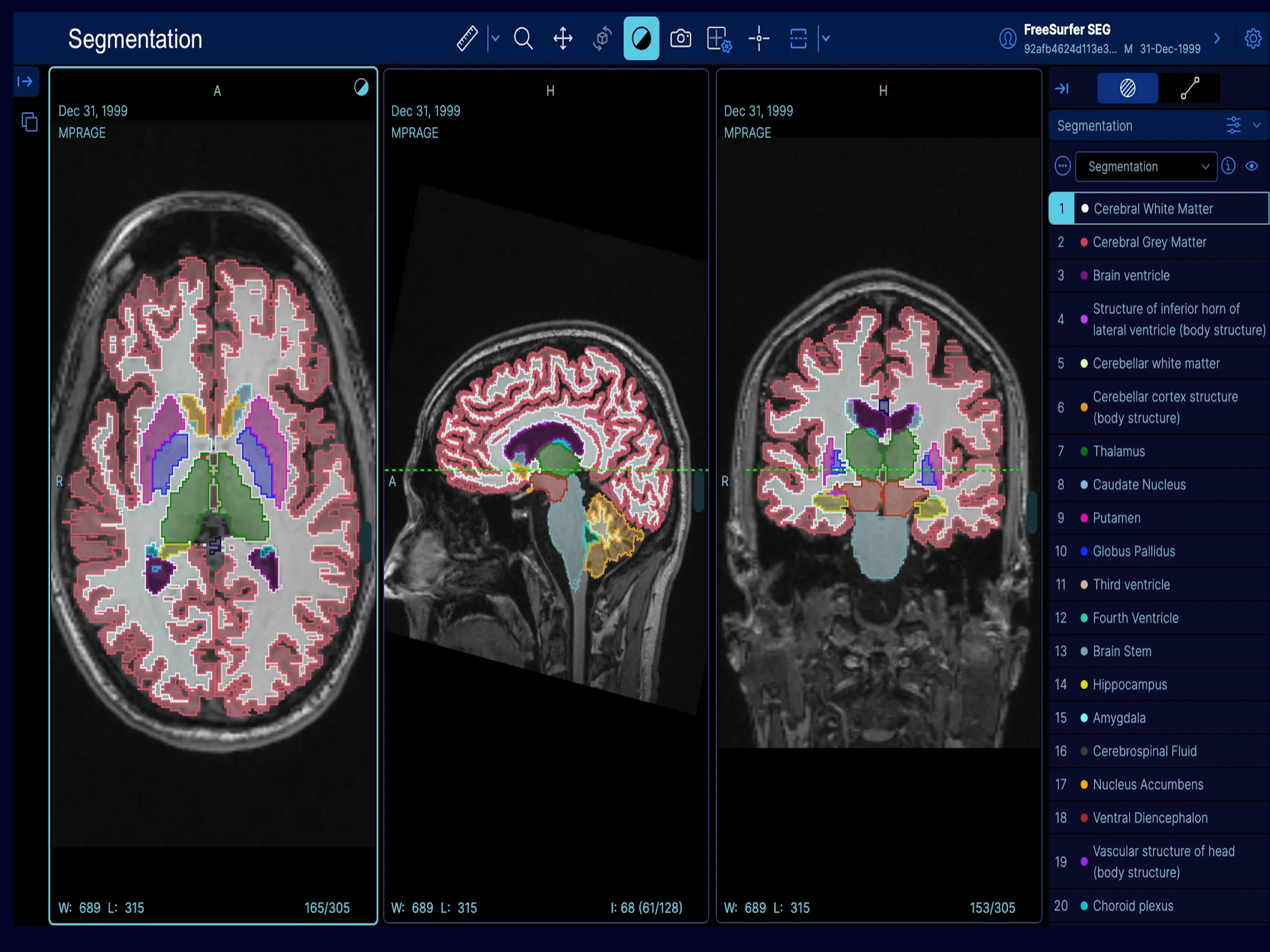 EazyGo | Easy PACS & DICOM screenshot 12