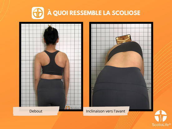 Screenshot #6 pour Scoliomètre
