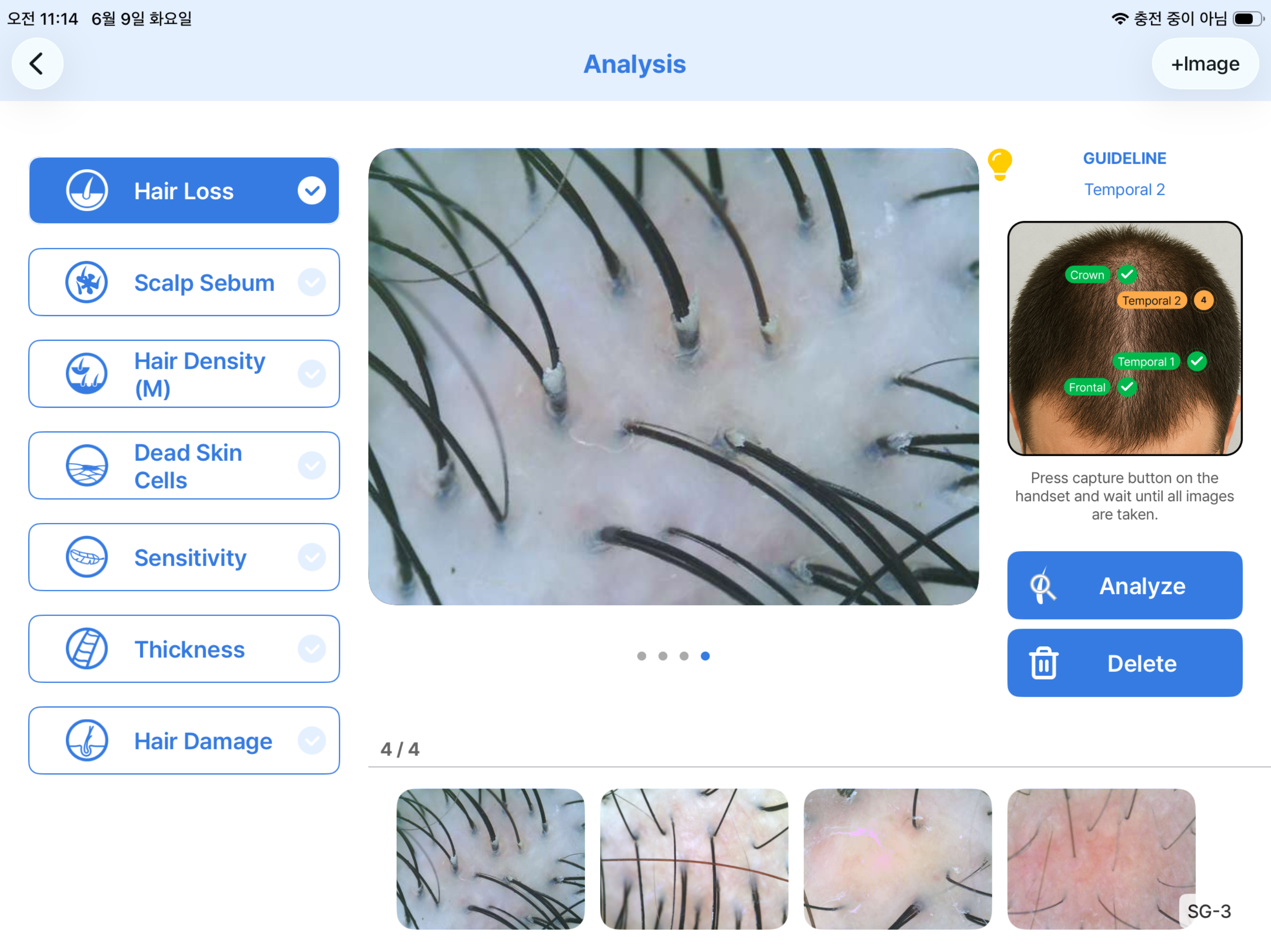 ChoiceDX Pro-Hair 2 screenshot 9