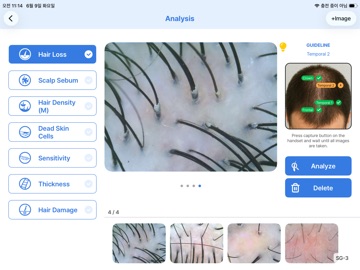 ChoiceDX Pro-Hair 2 iPad screenshot