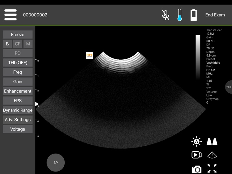 IBEX Wireless Ultrasound