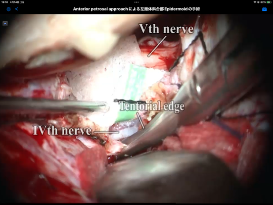 Screenshot #4 pour Medical KOS