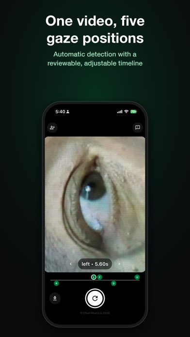 Iris Vision iPhone screenshot