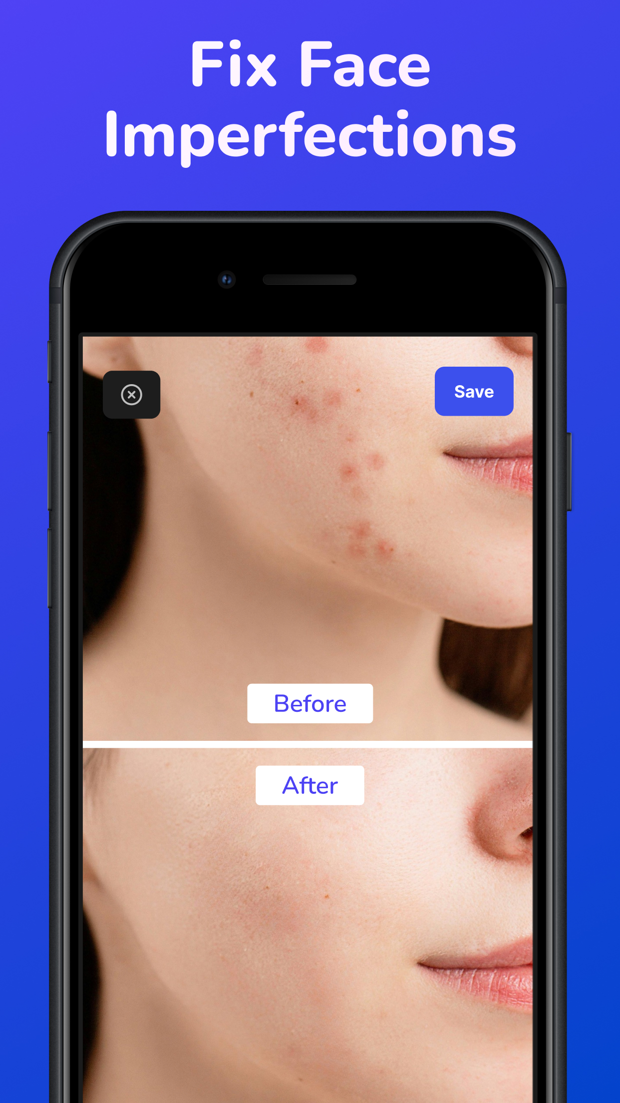 AI Eraser - Object Remover
