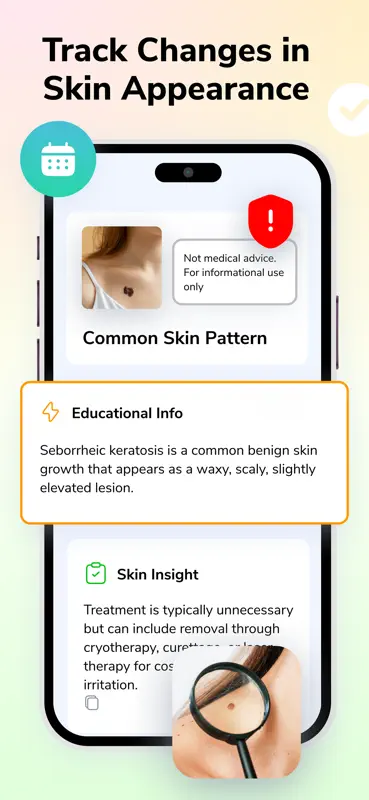 Mole Checker - Skin Scanner screenshot 2 of 4