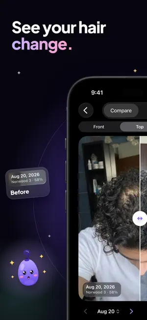 Keep Hair: Hair Loss Tracker screenshot 1